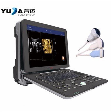 Lub Tsev Kho Mob 15 Nti LCD Portable Laptop Xim Xim Ultrasound