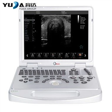 Phau Ntawv Sau Digital Digital Ultrasound Scanner